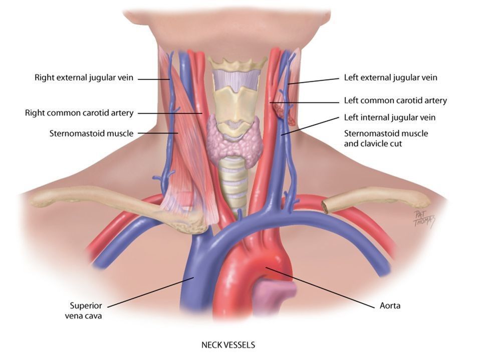 Брахиоцефальные артерии (БЦА)